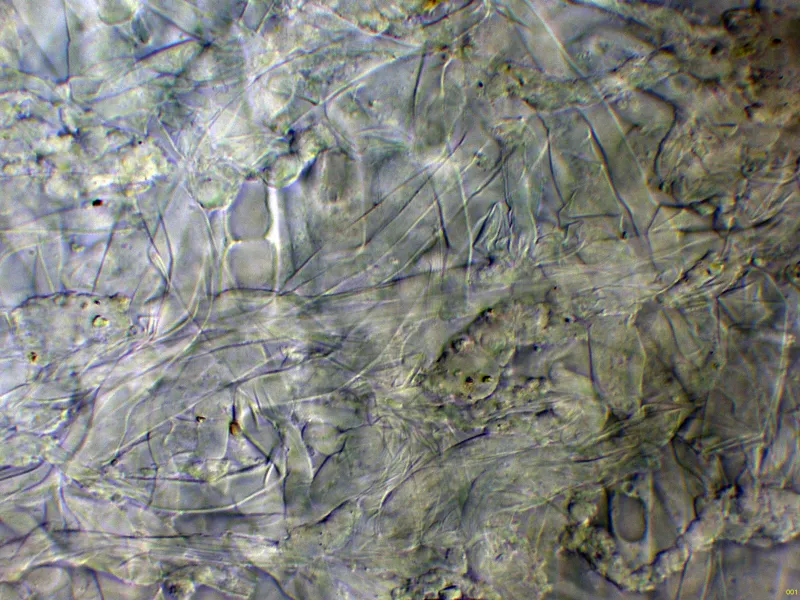 Amylosporus campbellii 11 - Suprapellis agua-001